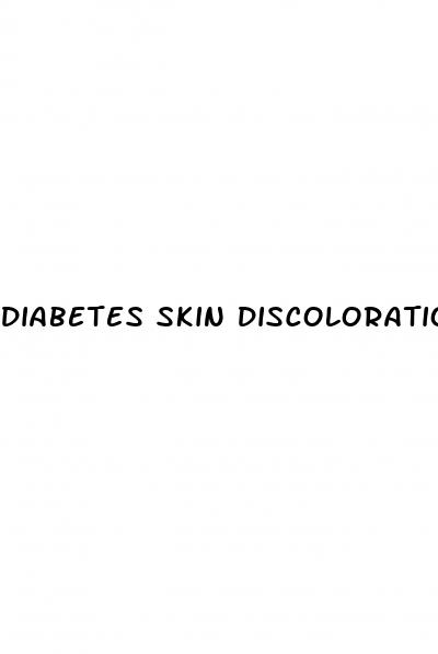 diabetes skin discoloration