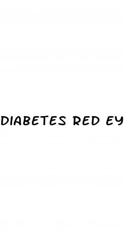 diabetes red eyes