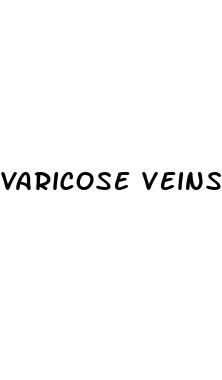 varicose veins and low blood pressure