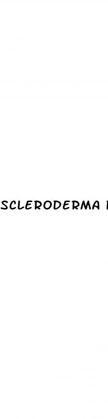 scleroderma pulmonary hypertension symptoms
