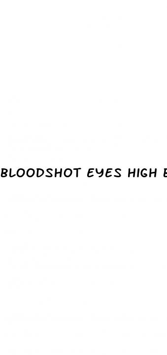 bloodshot eyes high blood pressure