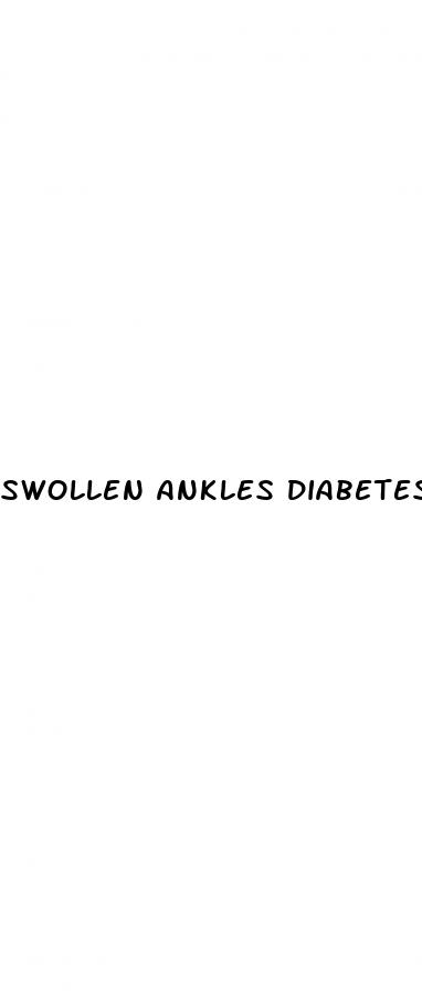 swollen ankles diabetes