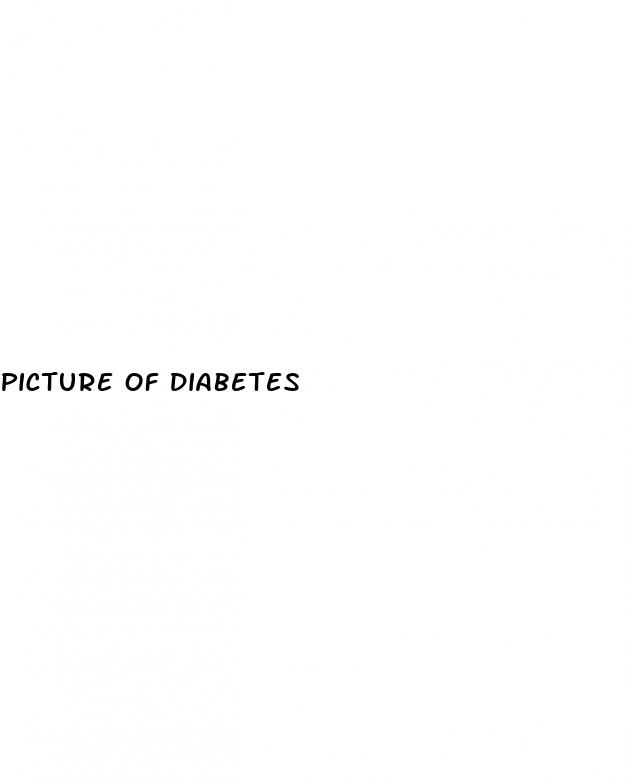 picture of diabetes