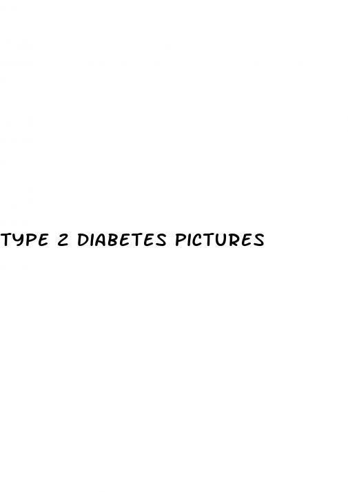 type 2 diabetes pictures