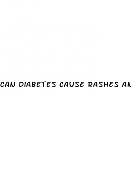 can diabetes cause rashes and itching