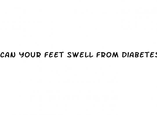 can your feet swell from diabetes