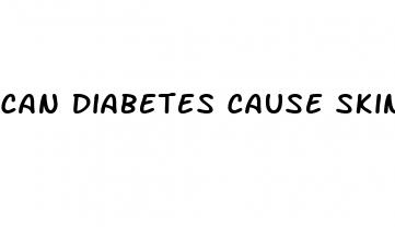 can diabetes cause skin itching