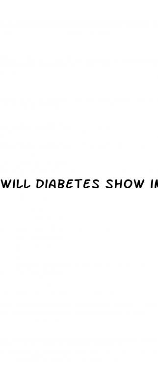 will diabetes show in a blood test