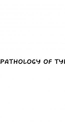 pathology of type 2 diabetes