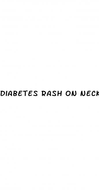 diabetes rash on neck