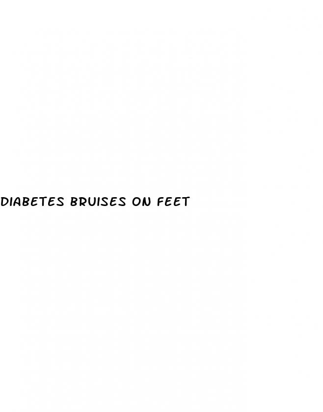 diabetes bruises on feet