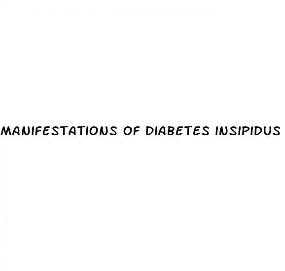 manifestations of diabetes insipidus