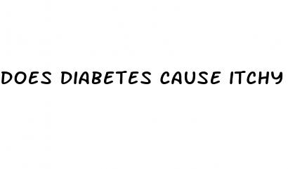 does diabetes cause itchy hands