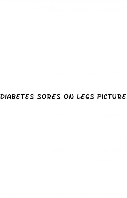 diabetes sores on legs pictures