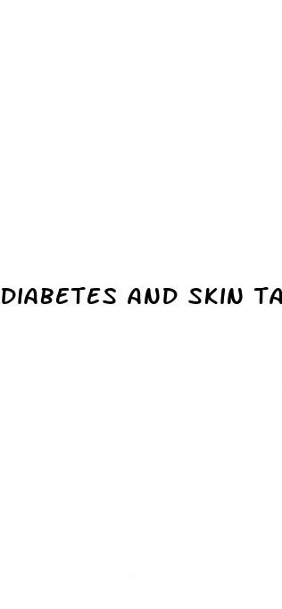 diabetes and skin tags