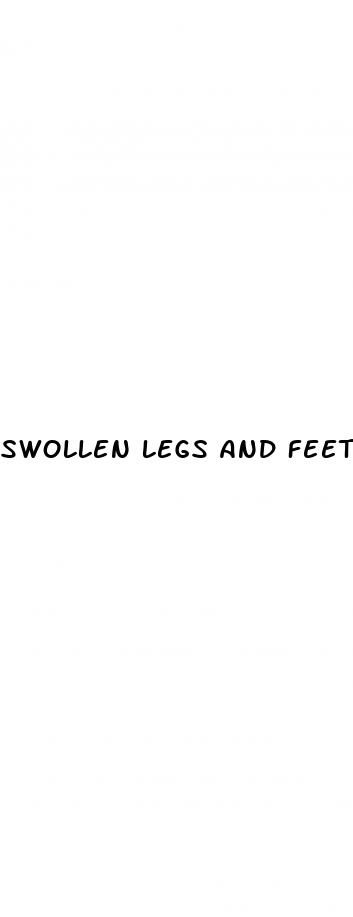 swollen legs and feet diabetes
