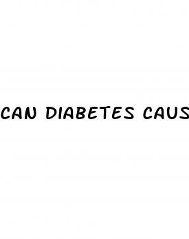 can diabetes cause edema in legs