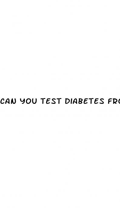 can you test diabetes from urine