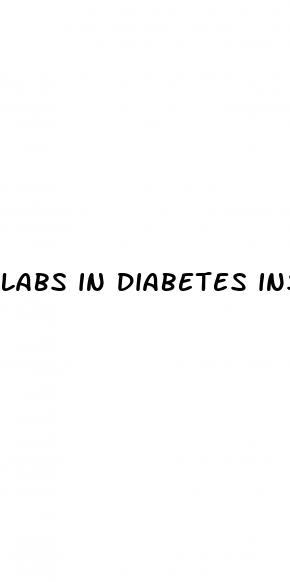 labs in diabetes insipidus