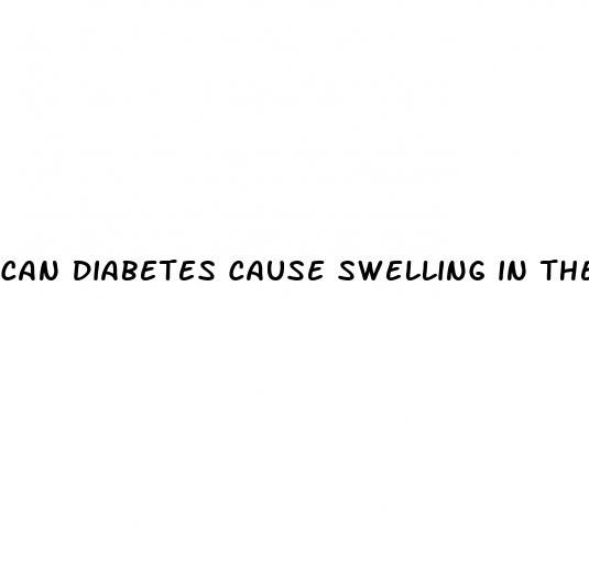 can diabetes cause swelling in the feet