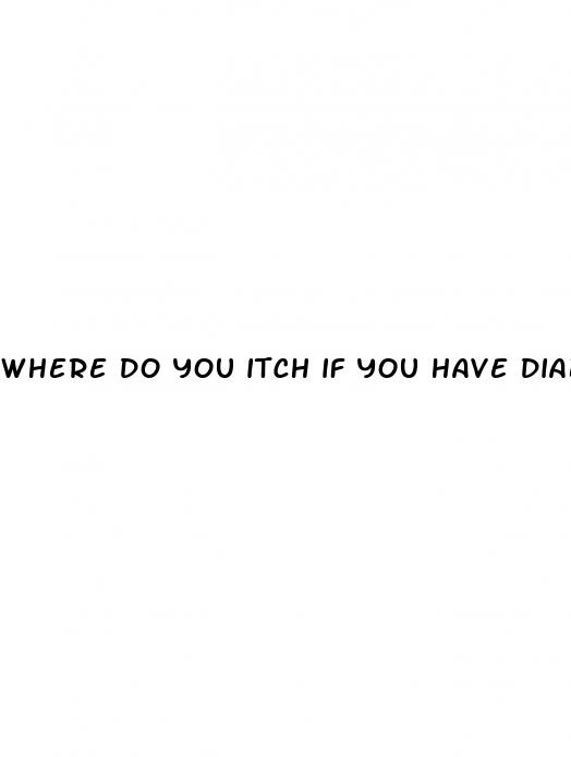 where do you itch if you have diabetes