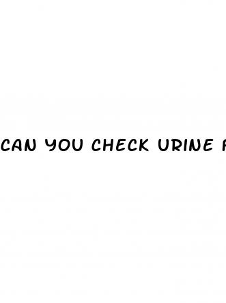 can you check urine for diabetes