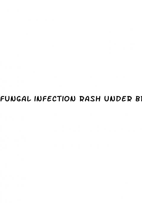 fungal infection rash under breasts diabetes