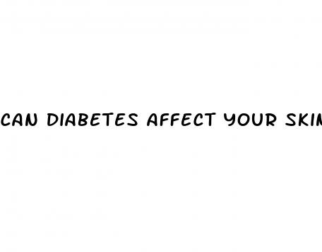 can diabetes affect your skin
