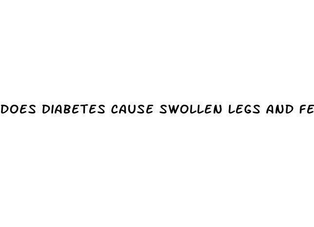 does diabetes cause swollen legs and feet