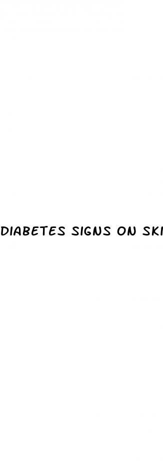 diabetes signs on skin