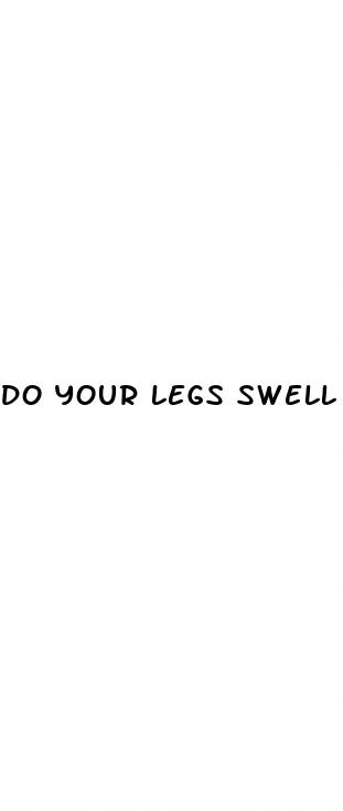 do your legs swell with diabetes
