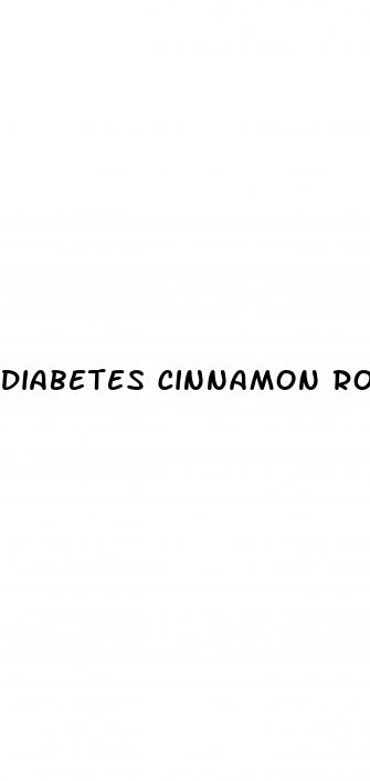 diabetes cinnamon rolls