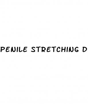 penile stretching device