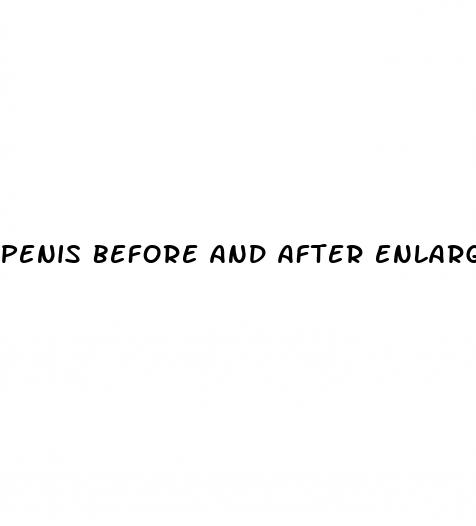 penis before and after enlargement