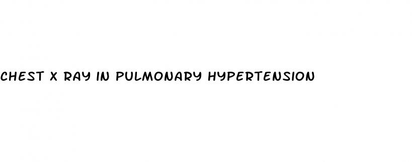 chest x ray in pulmonary hypertension