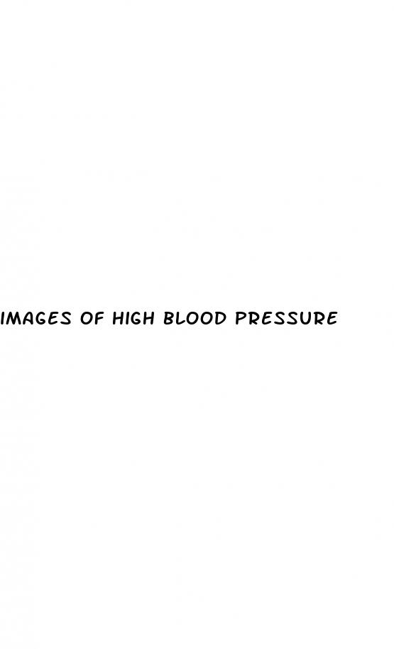 images of high blood pressure