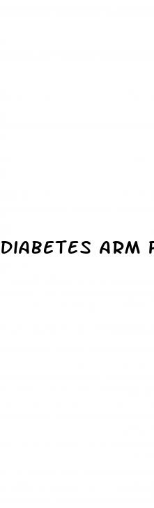 diabetes arm pain