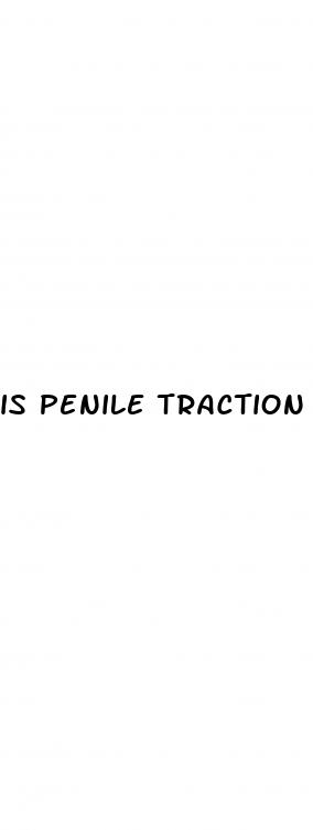is penile traction safe