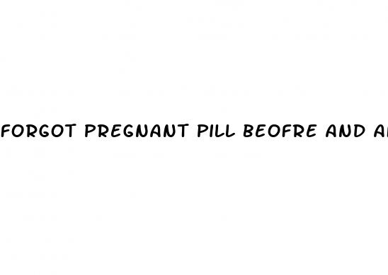 forgot pregnant pill beofre and after sex