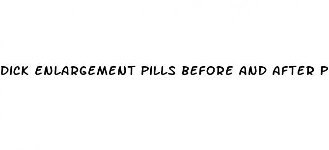dick enlargement pills before and after pics