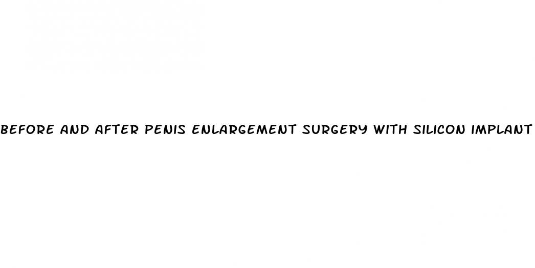 before and after penis enlargement surgery with silicon implant