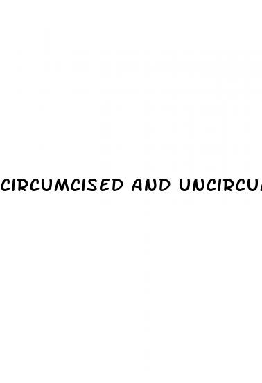 circumcised and uncircumcised penis erect
