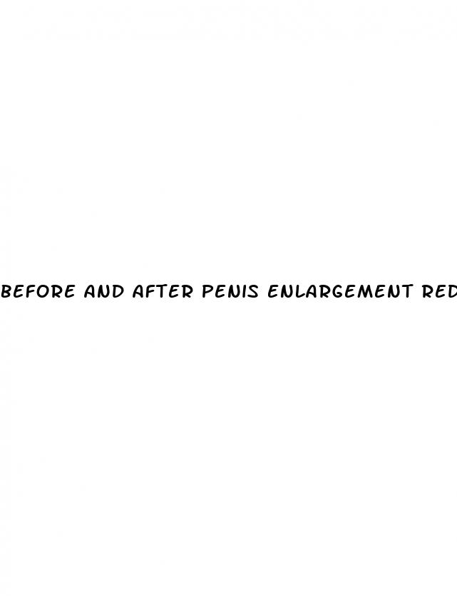 before and after penis enlargement reddit