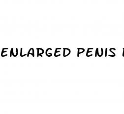 enlarged penis before and after slicon
