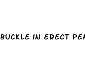 buckle in erect penis