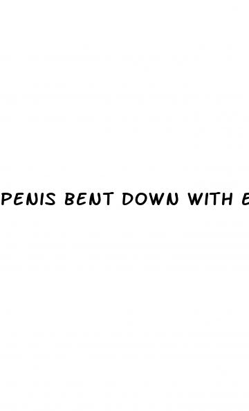 penis bent down with erection from masturbation