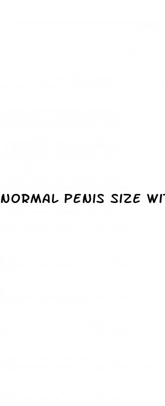 normal penis size without erection