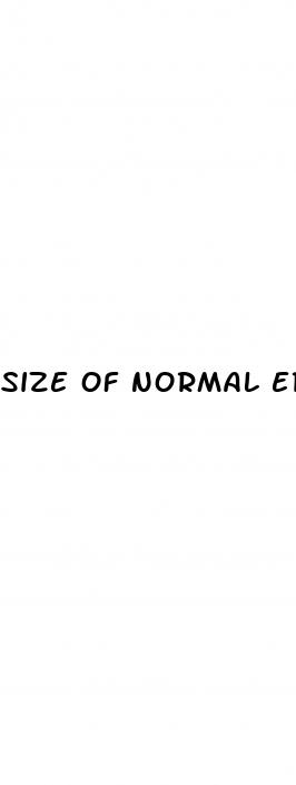 size of normal erect penis