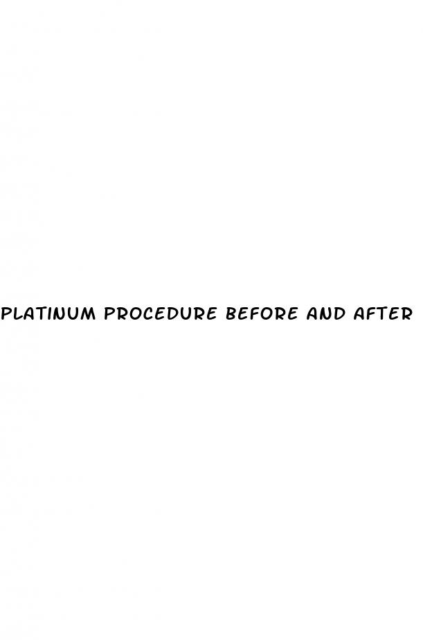 platinum procedure before and after