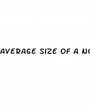 average size of a non erect penis